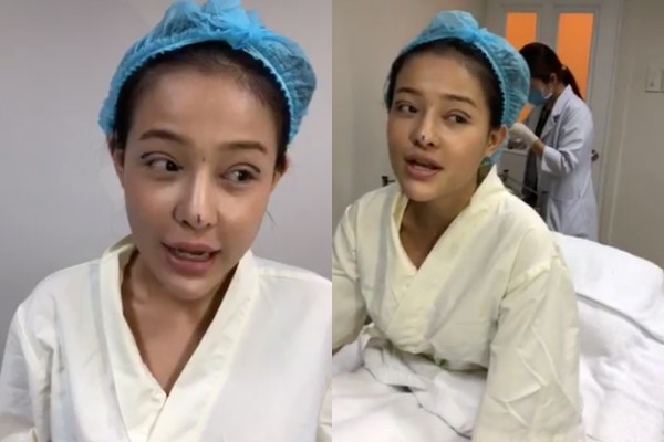 View - Ngân 98 giữ kỷ lục đệ nhất dao kéo, nhan sắc ra sao mà vẫn bị gièm pha càng sửa càng xấu