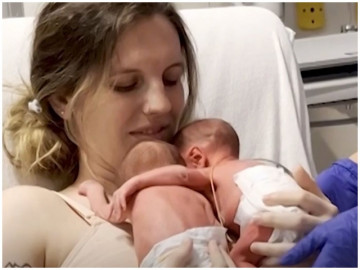 Khoảnh khắc đặc biệt hiếm có: Cặp song sinh choàng tay ôm nhau sau 5 ngày xa cách