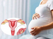 Bà bầu - Người phụ nữ 34 tuổi bị sốc mất máu do khối chửa ngoài tử cung vỡ