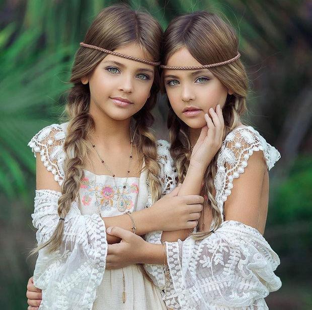 The most beautiful twins in the world have eyes that attract millions of people, 13 years later the beauty is even better - 4