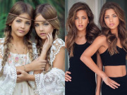 Làm mẹ - Cặp song sinh đẹp nhất thế giới có đôi mắt hút hồn triệu người, 13 năm sau vẻ đẹp còn xuất sắc hơn