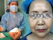 Làm đẹp - Cụ bà U70 vẫn thích trẻ, con gái liền đưa đi căng da mặt, 9 ngày sau trở về, gia đình nhận không ra