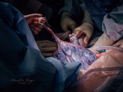 Bà bầu - Những hình ảnh hiếm thấy về nhau thai - nguồn dinh dưỡng của bé khi còn trong bụng mẹ