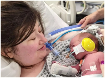 Phớt lờ cơn đau đầu tưởng đơn giản, bà bầu suýt mất mạng cả mẹ và thai nhi