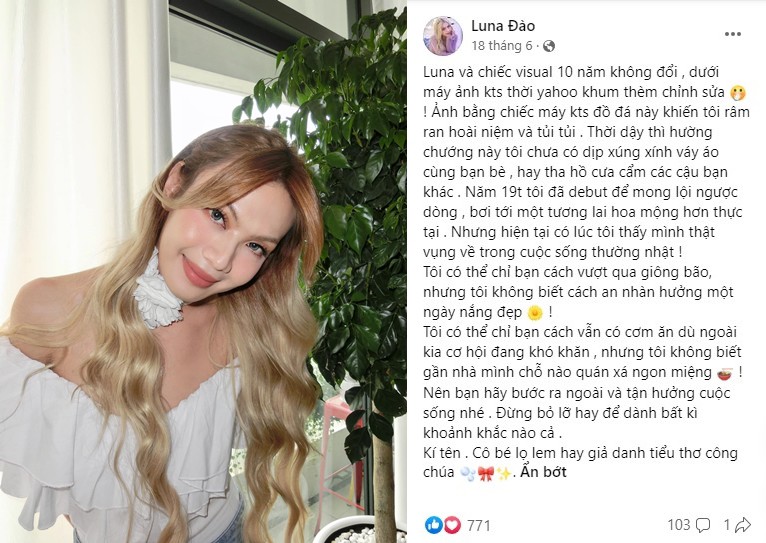 View - Chàng trai The Voice giờ là búp bê sống, đẹp tới mức phải vặn mũi chứng minh hàng tự nhiên