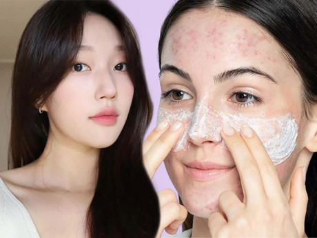 Không phải vì ở bẩn, các chuyên gia cho biết người có mụn nội tiết đều chung thói quen xấu này