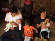 Tin tức - Hai bé gái song sinh vừa chào đời được bác sĩ chẩn đoán hở hàm ếch, bố không hiểu đó là gì