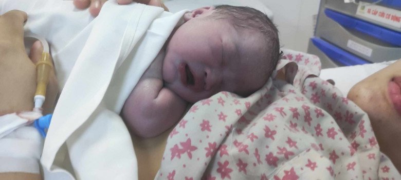 View - Mẹ bầu chia sẻ kinh nghiệm đặt bóng sinh thường chỉ tốn 1,5 triệu đồng, giúp chuyển dạ nhanh và ít đau