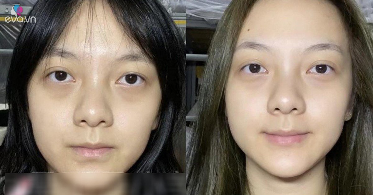 View - Thử cách chăm sóc da 0 đồng, cô gái đẹp lên không tưởng, làn da như được tái sinh