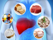 Sức khỏe - Có 3 kiểu ăn âm thầm bào mòn lá gan, nhiều người Việt biết nhưng vẫn thực hiện hằng ngày
