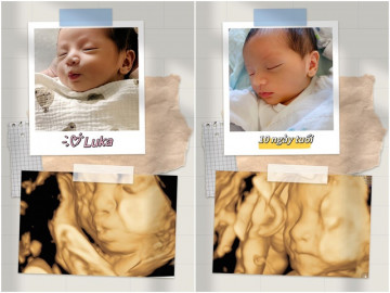 Liêu Hà Trinh thích thú khoe biểu cảm của con trai giống hệt ảnh siêu âm lúc mang bầu