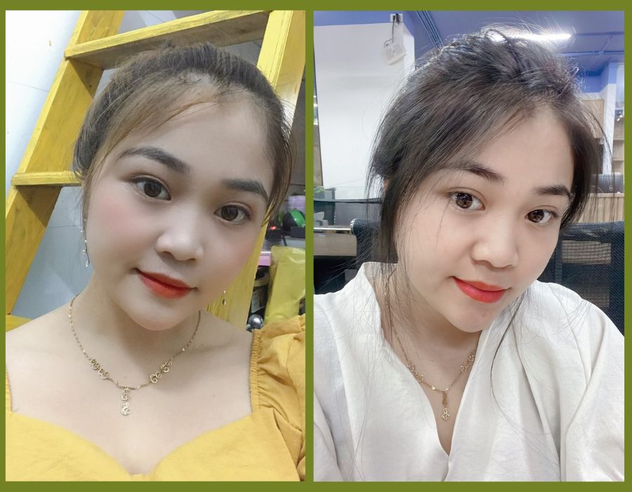 Dầu gội Haamp;#39;sol có giảm rụng tóc hiệu quả không? - 4