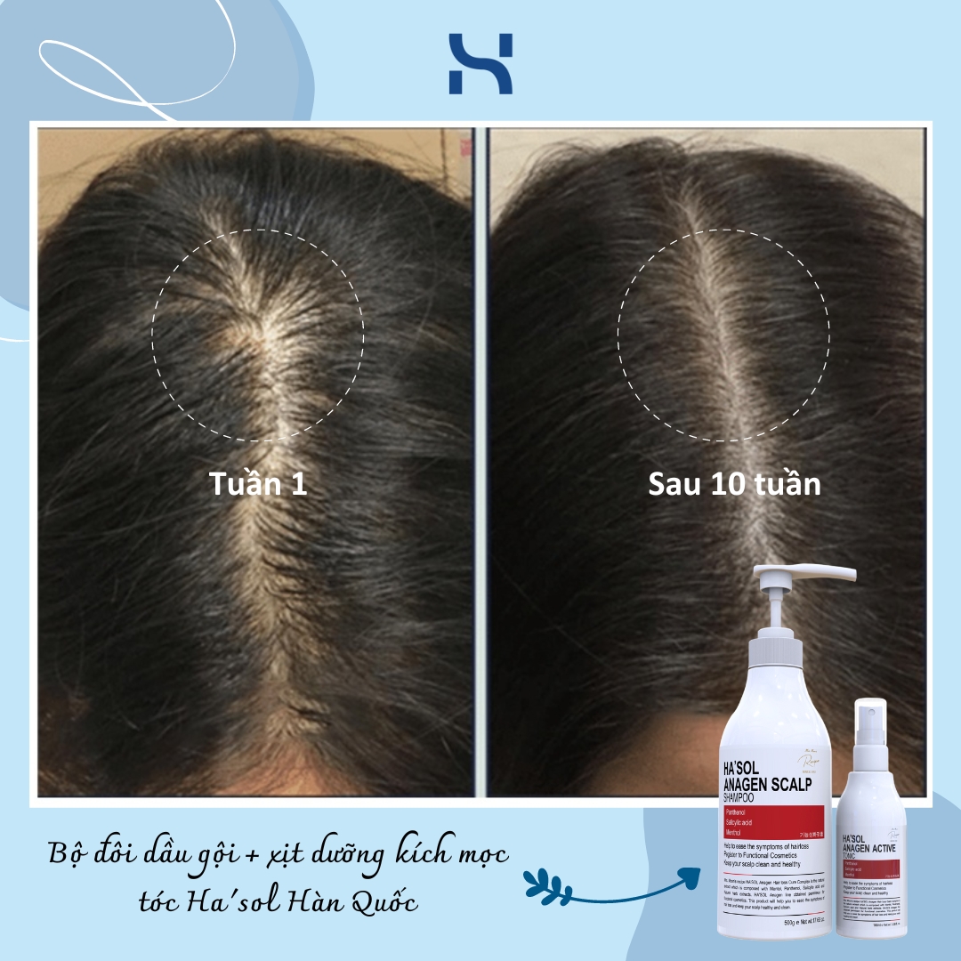 Combo Gội dầu gội Đỏ giảm rụng tóc + Xịt dưỡng Tonic hỗ trợ kích mọc tóc Ha’sol