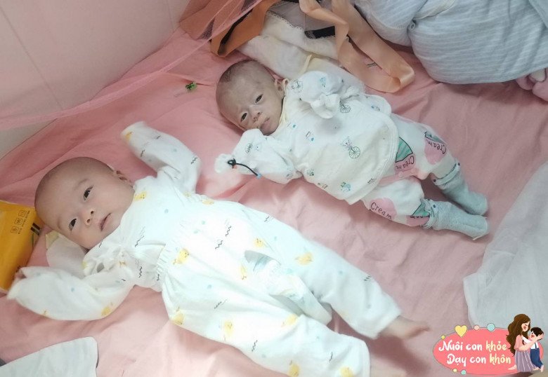Dù là sinh đôi nhưng có sự khác biệt về kích thước khi sinh ra