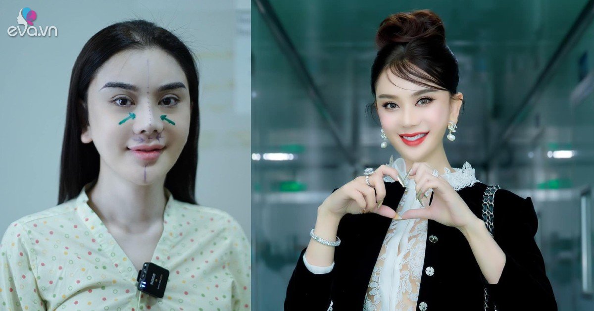 View - Lâm Khánh Chi tiếp tục chi tiền trùng tu nhan sắc tuổi U50, sang năm sửa tiếp vì chưa thoả mãn với một bộ phận