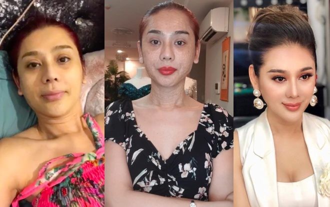 View - Lâm Khánh Chi tiếp tục chi tiền trùng tu nhan sắc tuổi U50, sang năm sửa tiếp vì chưa thoả mãn với một bộ phận