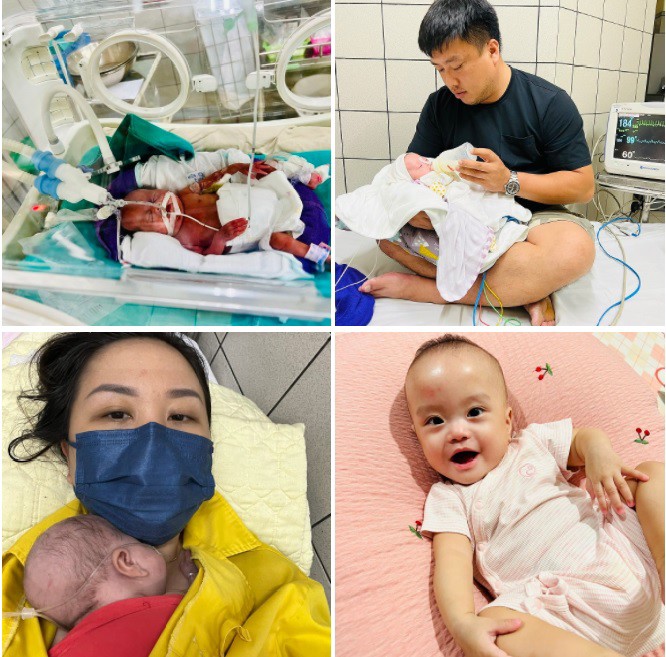 Hành trình sống kiên cường của bé An Chi, từ chỗ nằm lồng ấp, chỉ nhỏ xíu như chú chuột Hamster, xung quanh là máy móc, dây chuyền chằng chịt; sau một năm đã nặng 6,4kg, chiều cao 67cm, tình trạng sức khỏe bình thường.