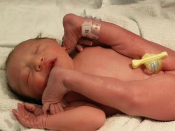 Em bé ngôi mông chào đời vẫn giữ nguyên tư thế trong bụng mẹ, người như gập làm đôi