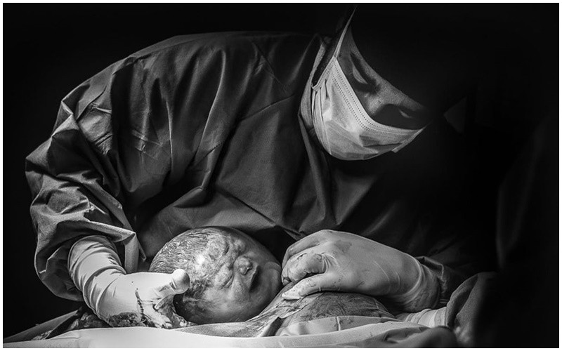 Khoảnh khắc sinh nở hiếm có khi em bé vẫn còn nguyên trong bọc ối đang òa khóc nức nở lúc chào đời. 
