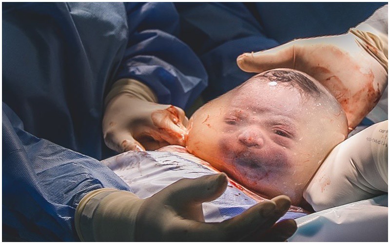 Cận cảnh gương mặt của em bé sơ sinh thông qua lớp màng ối, tạo ra khoảnh khắc ấn tượng.

