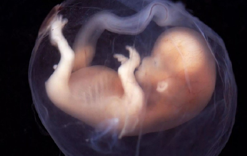 Một bé sơ sinh 40 ngày tuổi đã được Trung tâm Y tế Rahmania ở Bihar phát hiện mang một bào thai đang phát triển trong bụng. Hiện tượng kỳ lạ này được gọi là “thai trong thai”.
