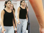 Giải trí - Nhóc Suri gây hoang mang khi lộ vết thương ở cổ tay, hình ảnh mới nhất tiết lộ tình trạng hiện tại