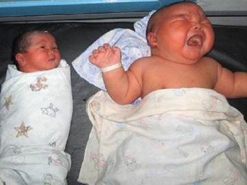Những em bé vừa chào đời đã khiến mọi người sửng sốt bởi điều kỳ lạ