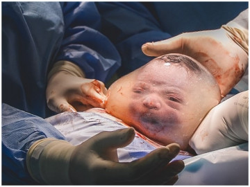 Muôn vàn biểu cảm thú vị của em bé khi vừa chào đời khiến cha mẹ tan chảy