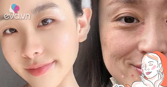 View - 8 loại thực phẩm rẻ như cho là máy bơm nước, chị em càng ăn da càng căng mọng, tuổi già né xa