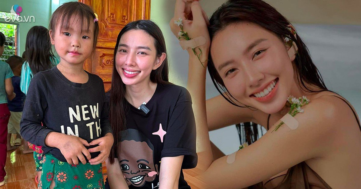 View - Thuỳ Tiên vén váy khoe làn da chi chít vết rạn nứt, Hoa hậu cũng như chị em hậu sinh nở