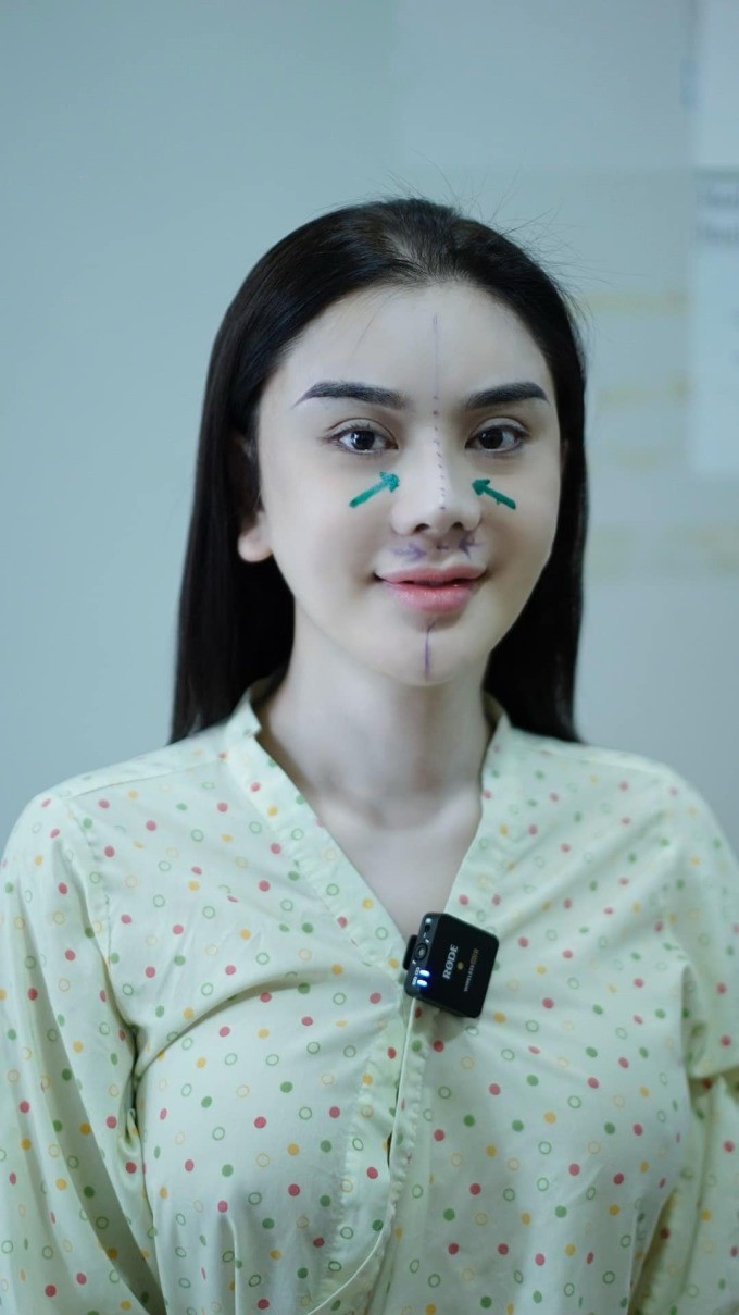 View - Xuất hiện Phạm Băng Băng Việt Nam da trắng môi trầm, chi tiền tỷ trùng tu, sửa mũi 2 lần mới đẹp