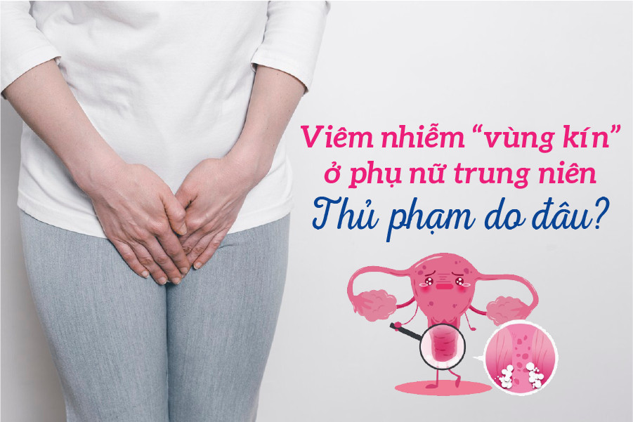 Viêm nhiễm “vùng kín” ở phụ nữ trung niên: Thủ phạm do đâu? - 1