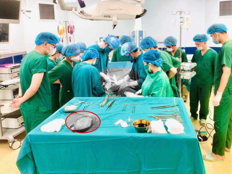 Ê kíp bác sĩ mổ lấy thai cho chị H. (Ảnh: BVSNPT)