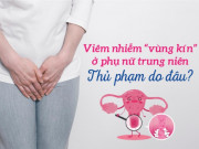 Sức khỏe - Viêm nhiễm “vùng kín” ở phụ nữ trung niên: Thủ phạm do đâu?