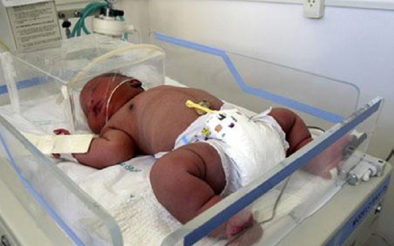 Bé sơ sinh "khổng lồ" ở Brazil chào đời tại bệnh viện Phụ sản Sabin Albert ở Salvador với cân nặng 7,6kg. Em bé là trẻ sơ sinh lớn nhất chào đời trong lịch sử 12 năm của bệnh viện.

