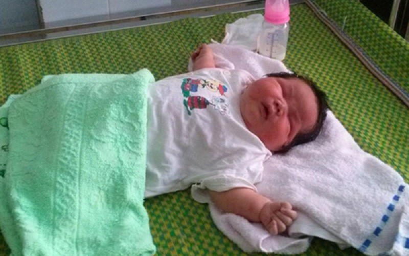 Bé trai ở Quảng Nam chào đời với cân nặng 6,5kg. Em bé được sinh ra bằng phương pháp sinh mổ, chuyển dạ ngôi đầu, mẹ bị tiền sản giật.
