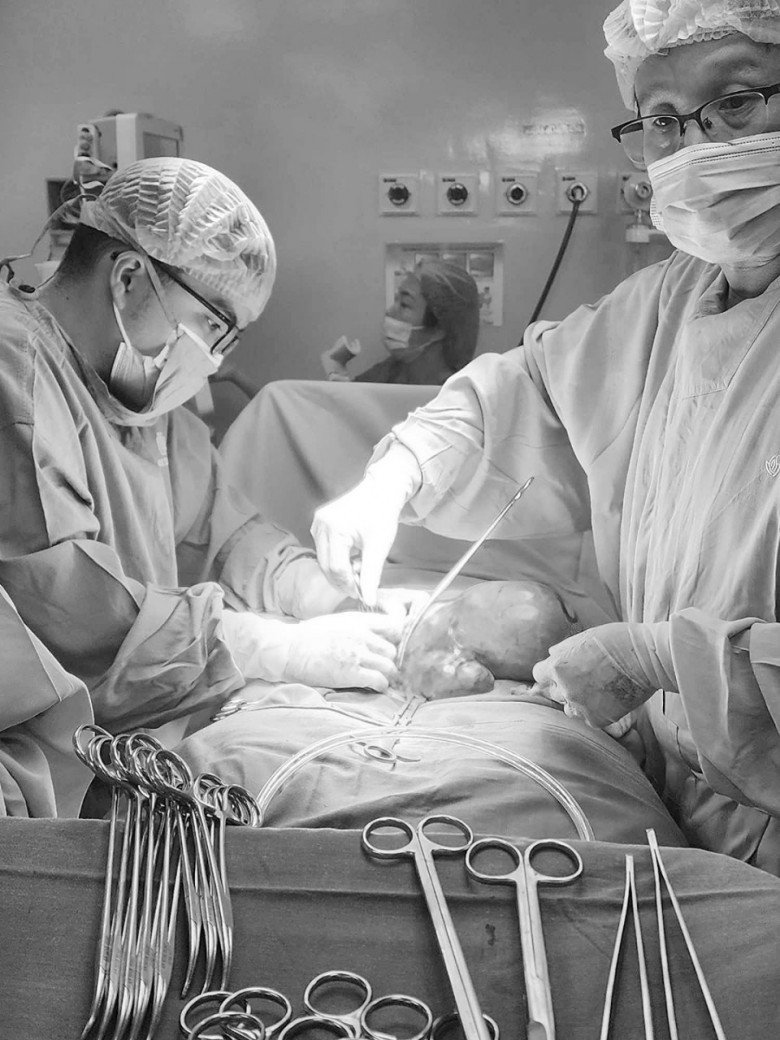 View - Bụng to nhanh như sắp đẻ, mẹ 1 con đi khám phát hiện khối u xơ tử cung nặng 4kg