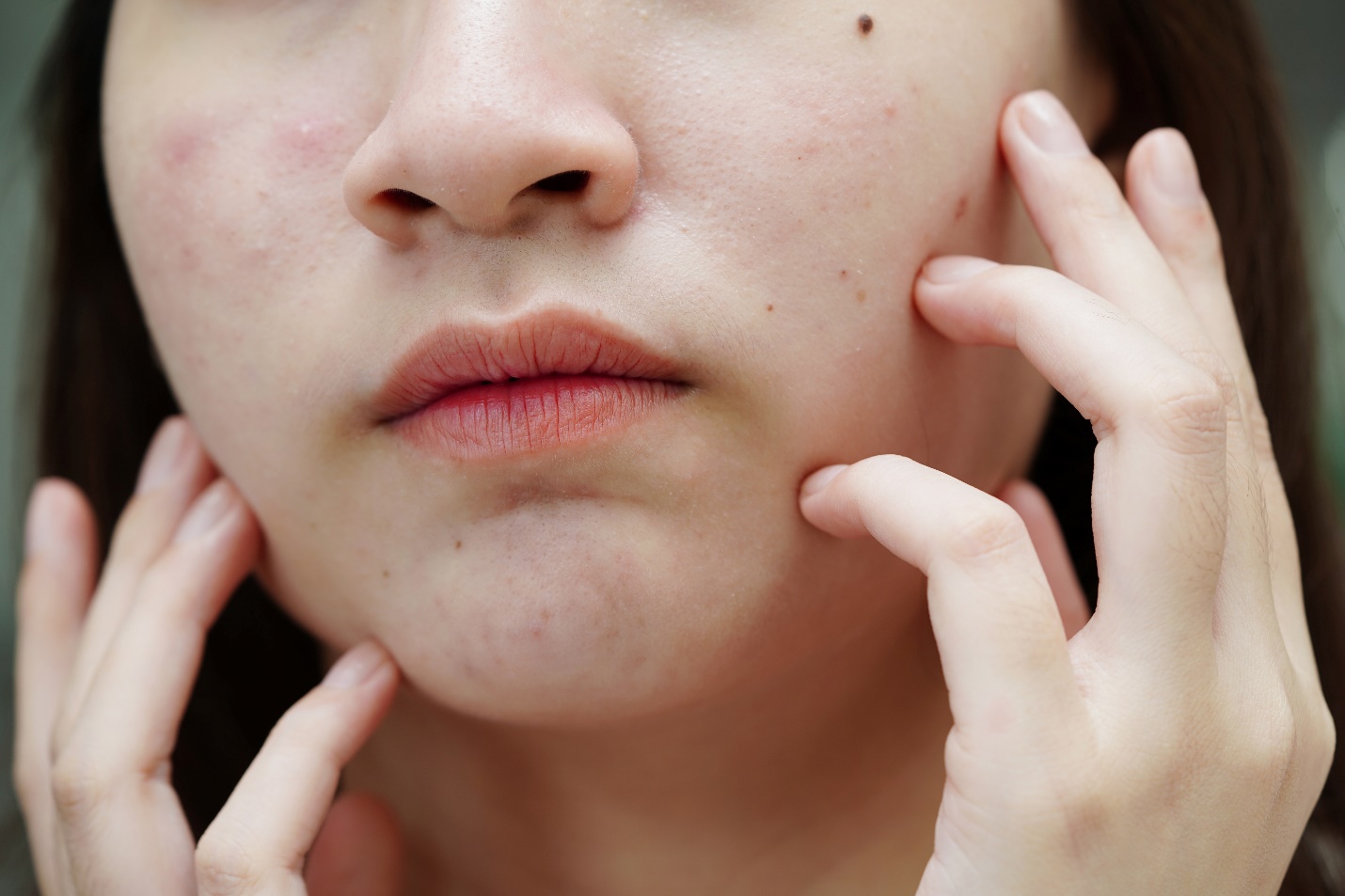 Xác định mức độ nhạy cảm của da, để biết cách chăm sóc da cẩn thận hơn.