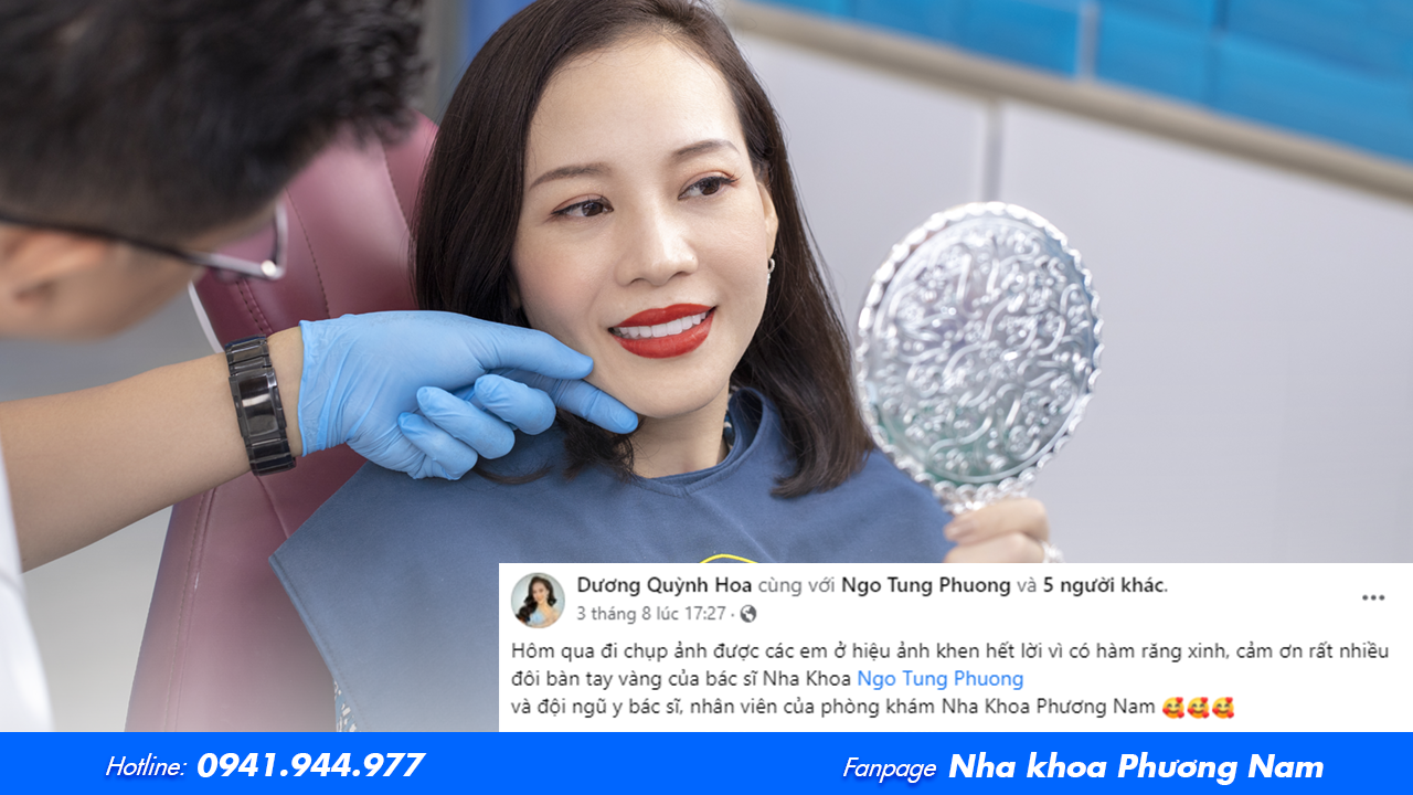  Chị Dương Quỳnh Hoa tiếp tục nâng cấp nụ cười mới tại Nha khoa Phương Nam với dán sứ Veneer