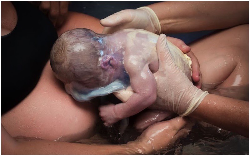 Còn có những em bé vẫn dính chặt lớp màng ối ở trên người sau khi chào đời.
