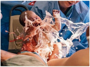 Bà bầu - Những khoảnh khắc đắt giá được ống kính nhiếp ảnh gia ghi lại trong phòng sinh