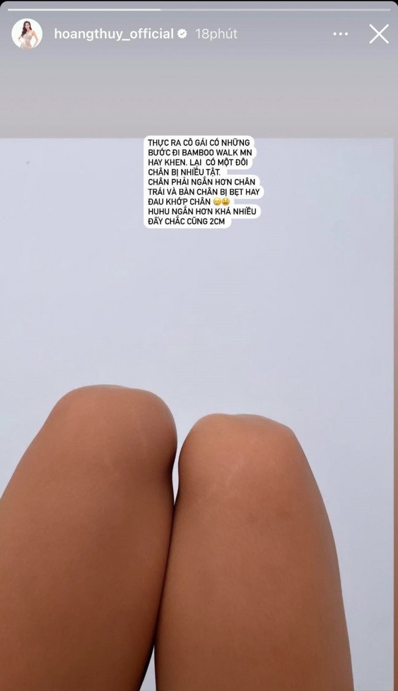 View - Cô gái cao 1m79 gội đầu ở Chạ Tiên có đôi chân lệch 2cm vẫn khiến bao người mơ ước