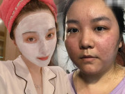 Làm đẹp - Chăm skincare mà da dẻ xấu hơn người lười dưỡng da, tất cả vì 5 sai lầm này