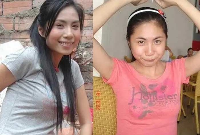 View - Ca sĩ Thủy Tiên vướng nghi vấn dao kéo vì 2 điểm khác lạ trên gương mặt, bị nói tâm sinh tướng