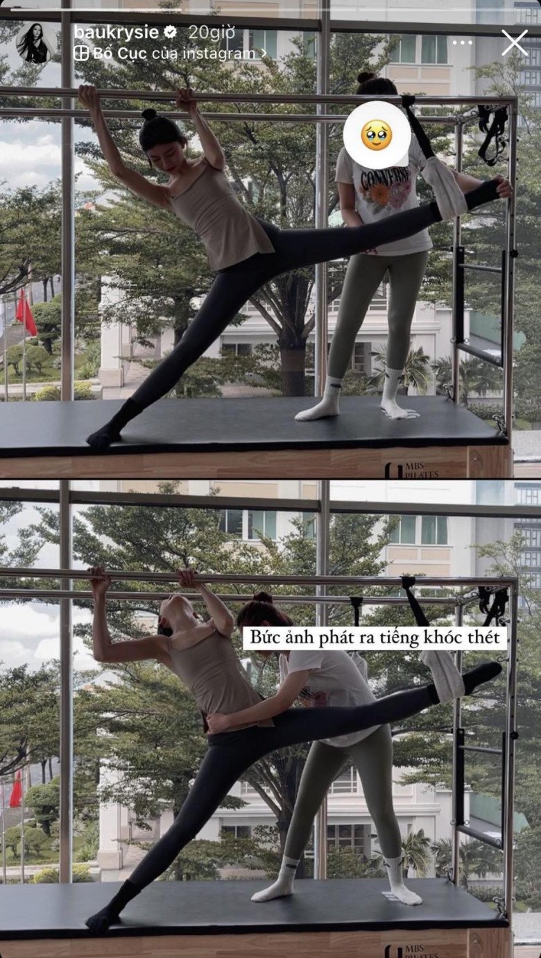 View - Lộn ngược tập Pilates và Pole Dance giữ dáng, nàng mẫu Sài thành gặp hiện tượng lạ trên da, chuyên gia lên tiếng
