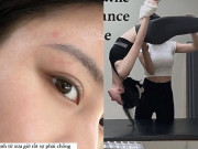 Làm đẹp - Lộn ngược tập Pilates và Pole Dance giữ dáng, nàng mẫu Sài thành gặp hiện tượng lạ trên da, chuyên gia lên tiếng