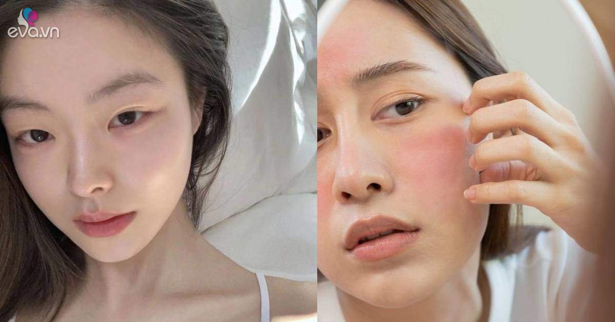 View - Sai lầm chăm sóc da mùa Thu - Đông, chị em không sửa ngay dễ khiến da lão hóa không phanh