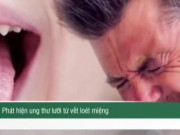 Clip Eva - Phát hiện ung thư lưỡi từ vết loét miệng