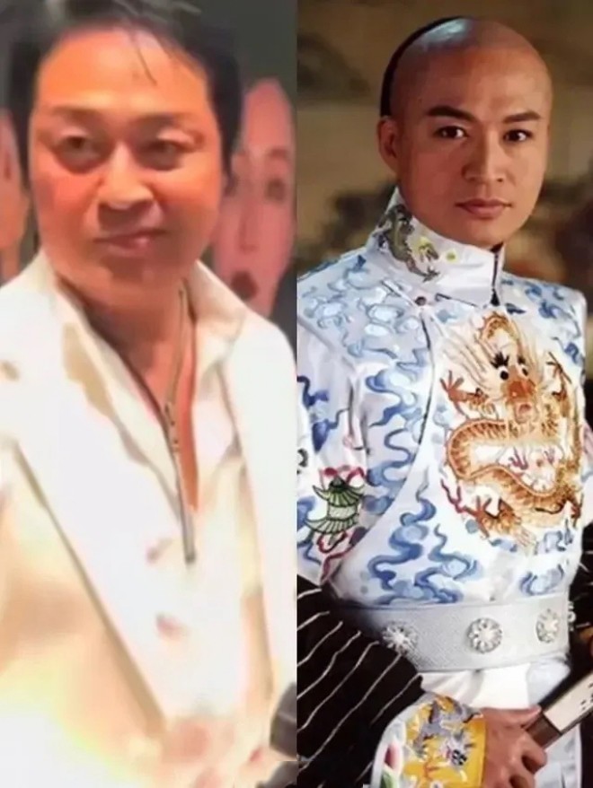 Vẻ ngoài điển trai của ông giờ khác biệt vì miệng méo.