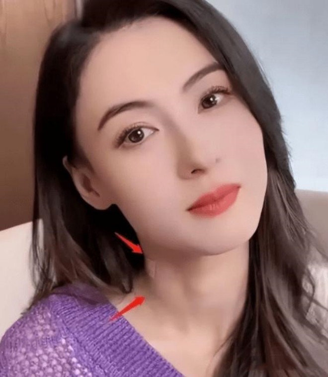 View - Trương Bá Chi - Bố của con trai út tác động vật lý, mẹ 3 con gương mặt thương tích nhưng cố giấu?